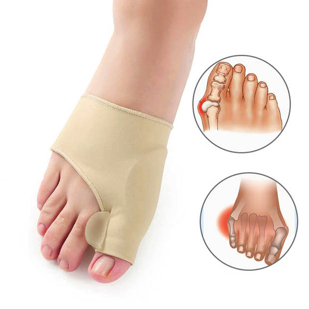 Mediroots - Hallux Valgus Teenbeschermers - 2 stuks - Teencorrectors