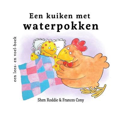 Memphis Belle baby- en peuterboek Een kuiken met waterpokken